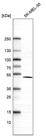VAT1 Antibody in Western Blot (WB)