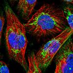 ABCB8 Polyclonal Antibody