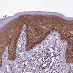 ABCB8 Antibody in Immunohistochemistry (IHC)
