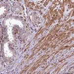ABCB8 Antibody in Immunohistochemistry (IHC)