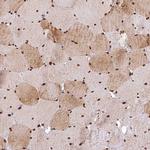 ABCB8 Antibody in Immunohistochemistry (IHC)