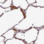 ADPGK Antibody in Immunohistochemistry (Paraffin) (IHC (P))