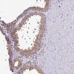 ADPGK Antibody in Immunohistochemistry (Paraffin) (IHC (P))