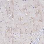 ADPGK Antibody in Immunohistochemistry (Paraffin) (IHC (P))