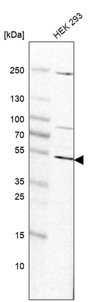 ADPGK Antibody in Western Blot (WB)