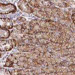 TBCD Polyclonal Antibody