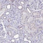 SSR4 Antibody in Immunohistochemistry (Paraffin) (IHC (P))