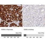 SSR4 Antibody in Immunohistochemistry (IHC)
