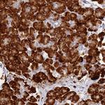 SSR4 Antibody in Immunohistochemistry (IHC)