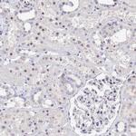 SSR4 Antibody in Immunohistochemistry (IHC)