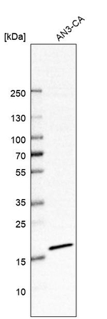 SSR4 Antibody in Western Blot (WB)