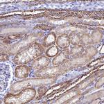 NDUFV1 Antibody in Immunohistochemistry (Paraffin) (IHC (P))
