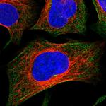 C6orf129 Polyclonal Antibody