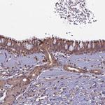 C6orf129 Antibody in Immunohistochemistry (IHC)
