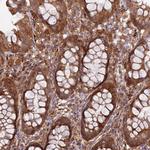 NDUFAF7 Antibody in Immunohistochemistry (Paraffin) (IHC (P))