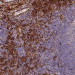 NDUFAF7 Polyclonal Antibody