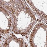 NDUFAF7 Antibody in Immunohistochemistry (IHC)