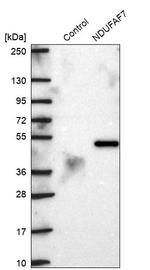NDUFAF7 Antibody in Western Blot (WB)