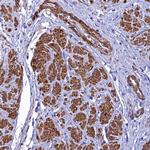 FADS3 Antibody in Immunohistochemistry (Paraffin) (IHC (P))