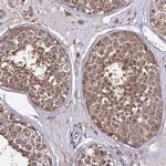 C2orf69 Polyclonal Antibody