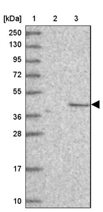 C2orf69 Antibody in Western Blot (WB)
