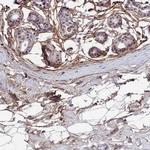 COL6A6 Antibody in Immunohistochemistry (IHC)