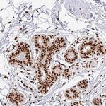 SIK3 Antibody in Immunohistochemistry (Paraffin) (IHC (P))