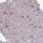 PCDHB14 Antibody in Immunohistochemistry (IHC)