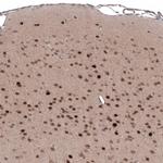 SCRT1 Antibody in Immunohistochemistry (Paraffin) (IHC (P))