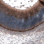 SCRT1 Antibody in Immunohistochemistry (Paraffin) (IHC (P))