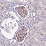 UBXN2B Antibody in Immunohistochemistry (Paraffin) (IHC (P))