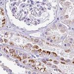 NAPSA Antibody in Immunohistochemistry (IHC)