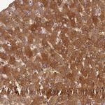 ADAMTS7 Polyclonal Antibody