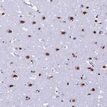 PRAMEF12 Polyclonal Antibody