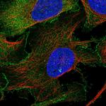 WAVE2 Antibody in Immunocytochemistry (ICC/IF)