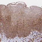 WAVE2 Antibody in Immunohistochemistry (Paraffin) (IHC (P))