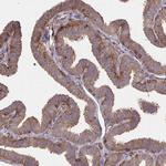 WAVE2 Antibody in Immunohistochemistry (Paraffin) (IHC (P))