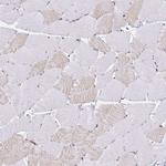 WAVE2 Antibody in Immunohistochemistry (Paraffin) (IHC (P))