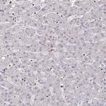 WAVE2 Antibody in Immunohistochemistry (IHC)