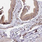 WAVE2 Antibody in Immunohistochemistry (IHC)