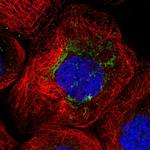 ANKRD34C Polyclonal Antibody