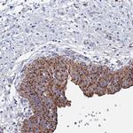 ANKRD34C Antibody in Immunohistochemistry (Paraffin) (IHC (P))