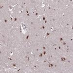 ZBED4 Antibody in Immunohistochemistry (Paraffin) (IHC (P))