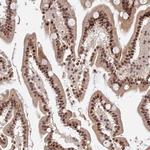 ZBED4 Antibody in Immunohistochemistry (Paraffin) (IHC (P))