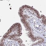 ZBED4 Antibody in Immunohistochemistry (Paraffin) (IHC (P))
