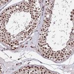 ZBED4 Antibody in Immunohistochemistry (Paraffin) (IHC (P))