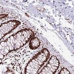 C6orf226 Antibody in Immunohistochemistry (Paraffin) (IHC (P))