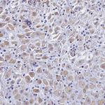 TRIM64B Polyclonal Antibody