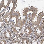 BOLA2 Polyclonal Antibody