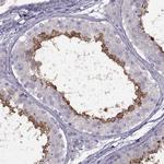 RSPH6A Antibody in Immunohistochemistry (IHC)